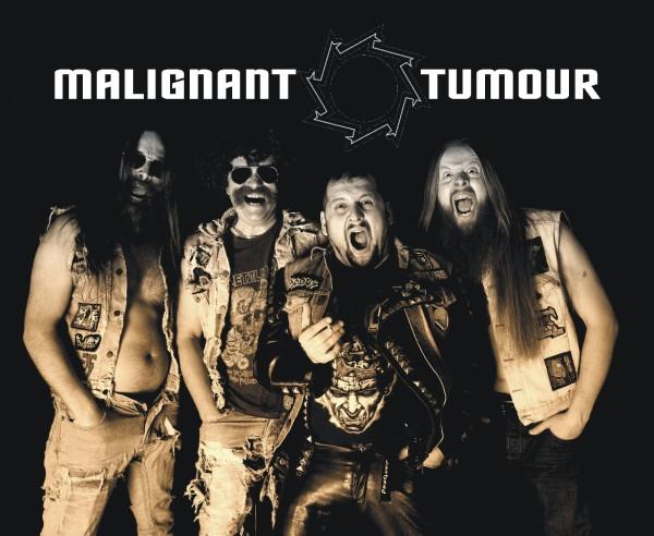 malignant tomour