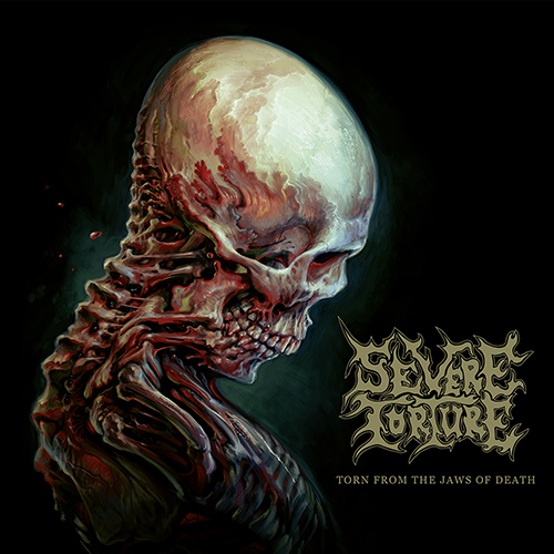 SevereTorture_Cover_Artwork